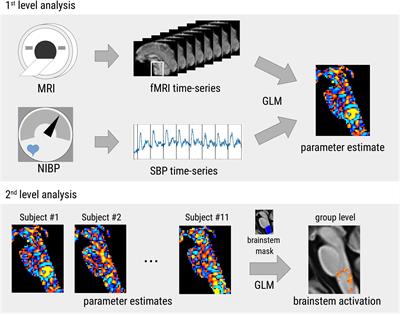 Novel Approach to Elucidate Human Baroreflex Regulation at the Brainstem Level: Pharmacological Testing During fMRI